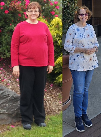 Kathy Before and After